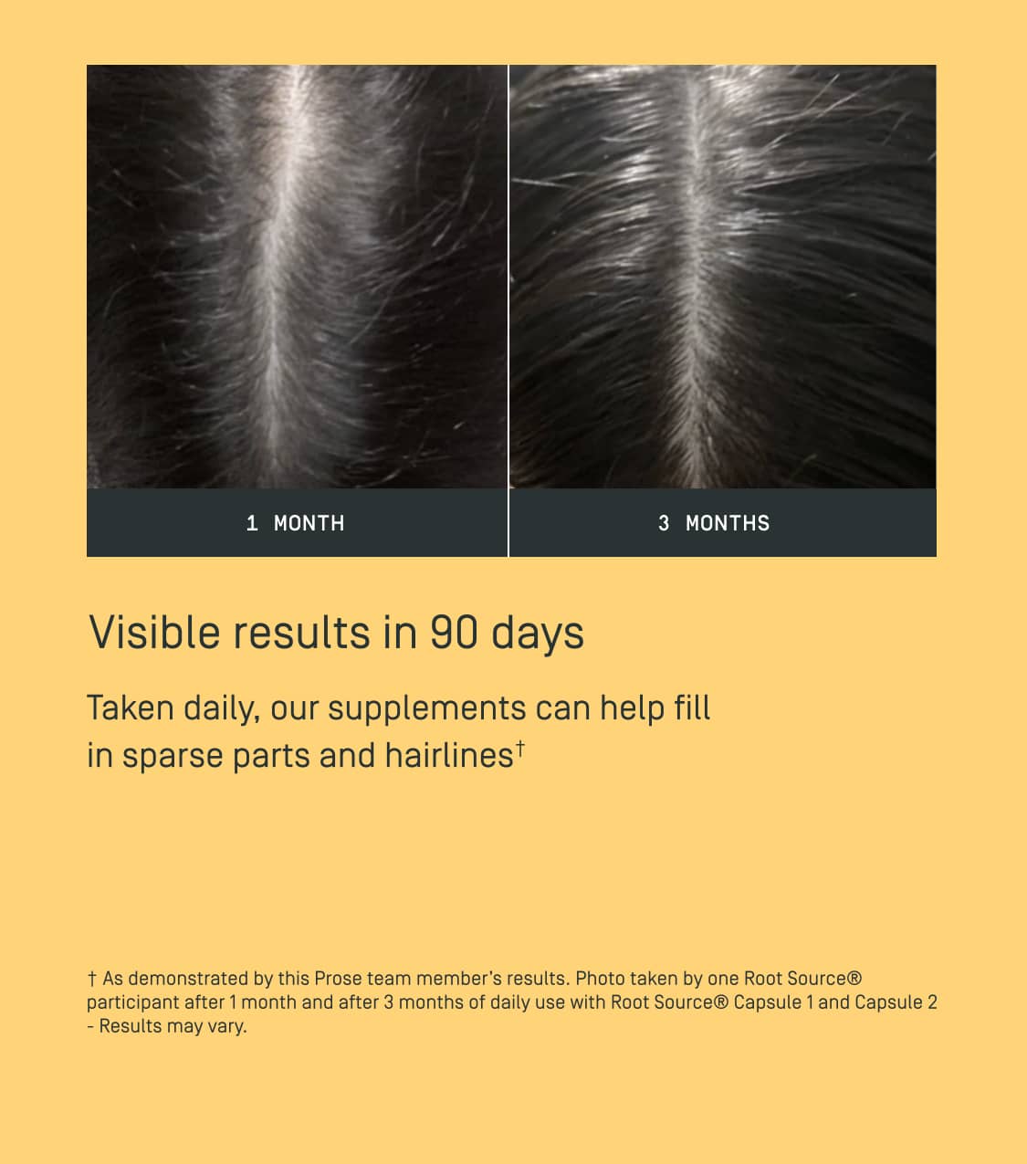 Prose custom root source hair supplements results after using for 90 days